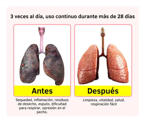 SPRAY NASAL DE HIERBAS 🫁
