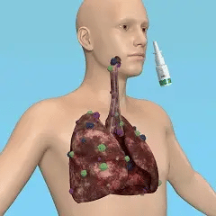 SPRAY NASAL DE HIERBAS 🫁